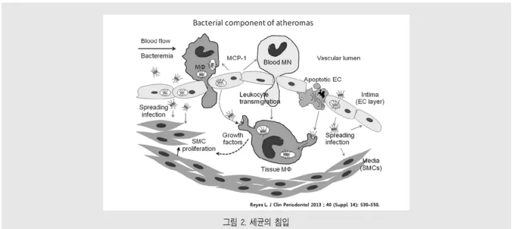 그림 2 는 microbial component가 invasion함 으로써 atherosclerosis에 관여하는 과정을 모식화 한 것 이 다 16) .  자 세 히 살 펴 보 면 ,  좌 측 부 터 Bacteremia-related bacteria가 endothelial layer를 침범하여 심부조직으로 이동하고 있다