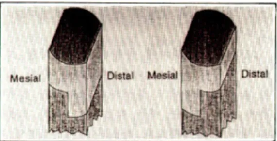 Fig. 1. The occlusal view of metal framework designs in natural teeth.