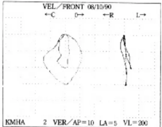 Fig. 10. PHOTO 3(M K G Sweep).