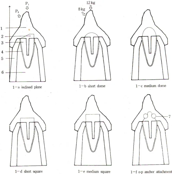 Fig. 1. Cross-sectional view of denture, coping abutment teeth and supporting structures.
