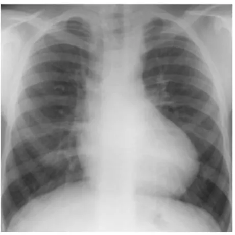 fig 2.  Diagram of COPD.