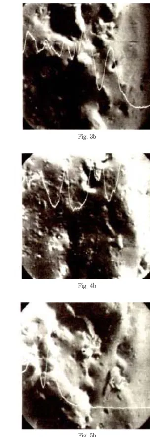 Fig. 3a Fig. 4a Fig. 5a Fig. 3bFig. 4bFig. 5b논문사진부도