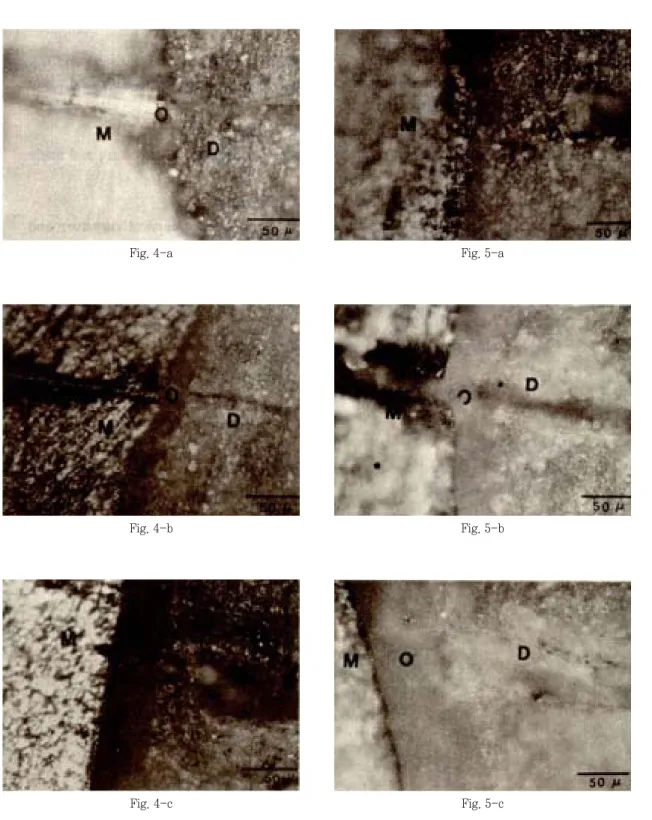Fig. 4-a Fig. 5-a