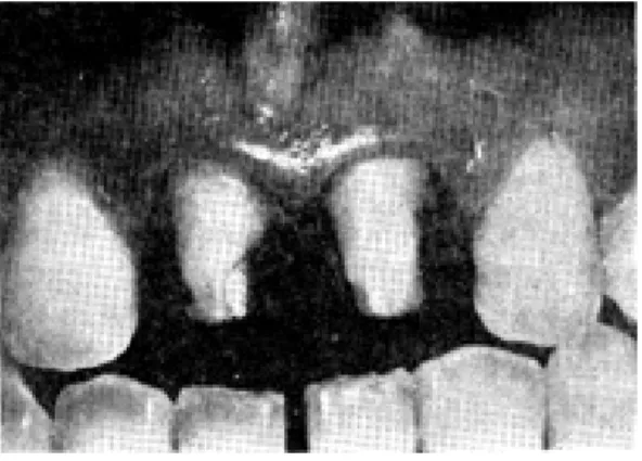 Fig. 3. Glass ingot and cartidge.