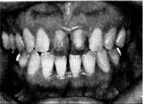 Fig. 7. Cerammed casting.