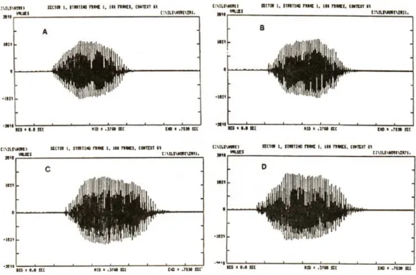 Fig. 3 : A view of the wave form display in 4 conditions(informant ; Z, Vowel : /ah(아))
