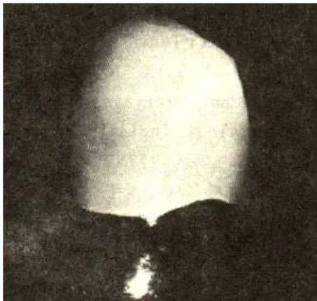 Fig. 6 : Finished metal-cermic crown.