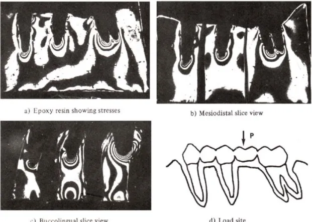 Fig. 9 : Stress distribution of application load to the 1st molar of rigid connector