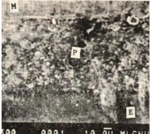 Fig. 4 : A SEM photomicrograph showing 30㎛ film thickness specimen(×500) (M : metal, P : panavia, E : enamel)
