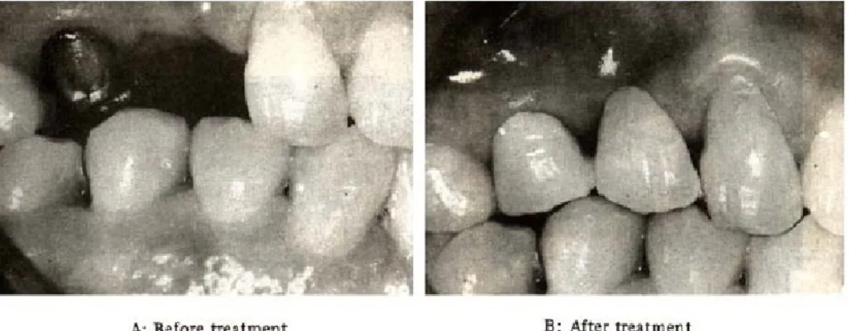 Fig. 6 : Failure case.
