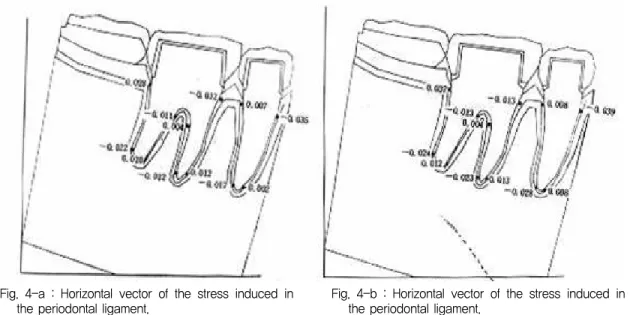 Fig. 4-a : Horizontal vector of the stress induced in the periodontal ligament.