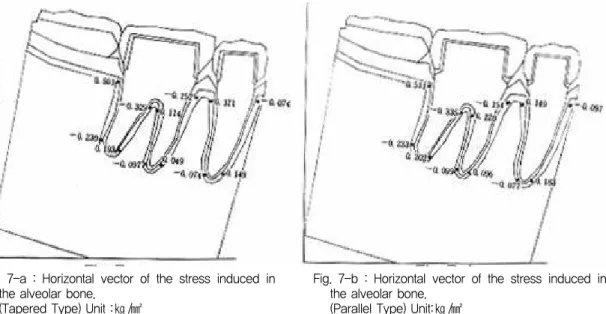 Fig. 6-b : Distribution of the equivalent stress in the periodontal ligament.