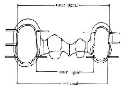 Fig. 2 : Buccal view of four-unit bridge with indexing needles(O : occlusal, C : cervical)