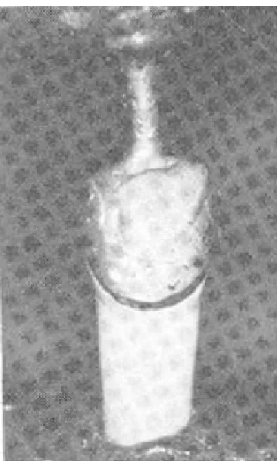 Fig. 1 : Resin Maxillary Central Incisor prepared PFM crown Fig. 2 : Cast coping(Verabond)