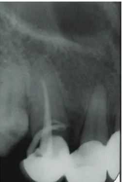 Fig. 1. An extraoral preoperative photograph shows the area with altered sensations.