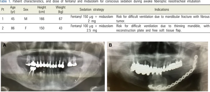 Fig 1. Reasons for conscious sedation. (A) Left lower fibrous tumor, (B) Postoperative infection after the patient underwent mandibular resection  and reconstruction with a metal instrument for left mandibular gingiva.