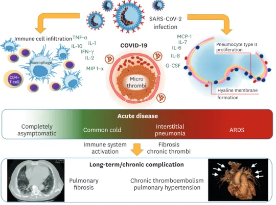 Figure 1. Possible clinical evolution of COVID-19. After the acute phase, the chronic evolution may reveal rare lung diseases
