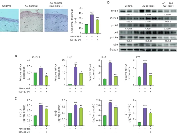 Figure 5. K284 reduces AD-like skin inflammation in AD-like RHS models. RHS model inserts were cultured for AD cocktail for 6 days