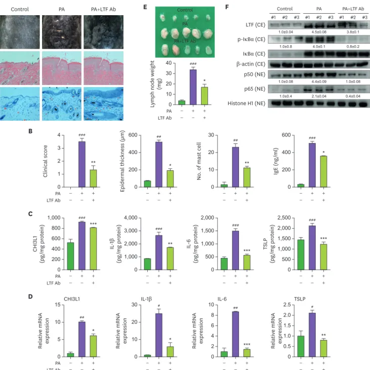 Figure 6. Blockade of LTF reduced PA-induced AD development. (A) PA solution was applied topically to the dorsal skin of mice in each group 3 times a week for  4 wk