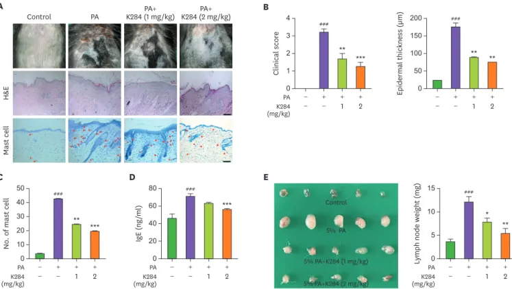 Figure 1. K284 inhibits PA-induced AD. (A) PA solution was applied topically to the dorsal skin of mice in each group 3 times a week for 4 wk