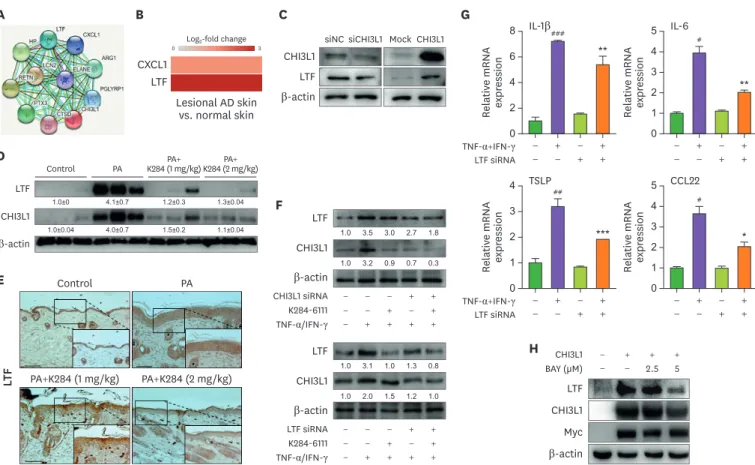Figure 4. K284 reduces LTF expression. (A) Protein-association network analysis of Chi3L1 (Human)