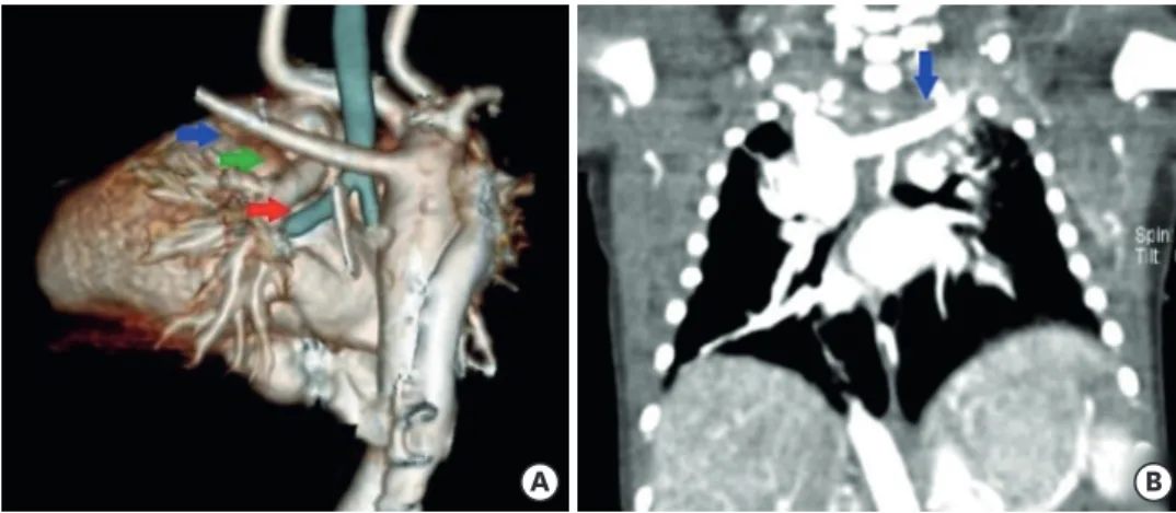 Fig. 3. Pulmonary 3D CT angiography. 
