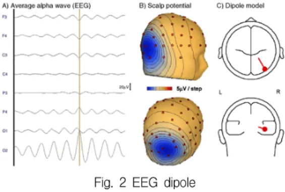 Fig.  2  EEG  dipole 
