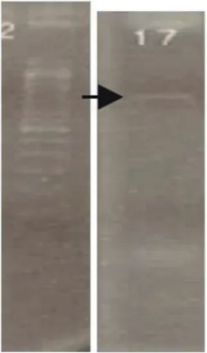 Figure 1. bla VIM-2  detected on 801 bp. band by PCR