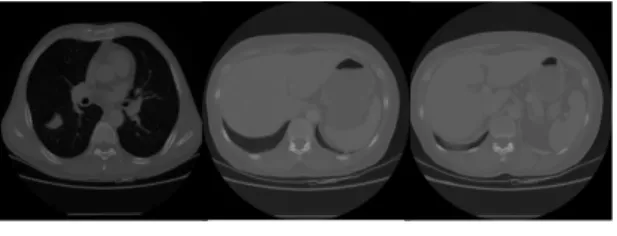 그림  3.  복부  CT/뇌  MR/경동맥  MRA  영상 Fig.  3  Abdominal  CT/Brain  MR/  CA  MRA  images