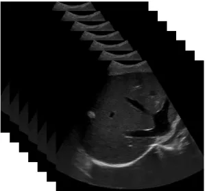 Figure 1. Ultrasound image acquisition
