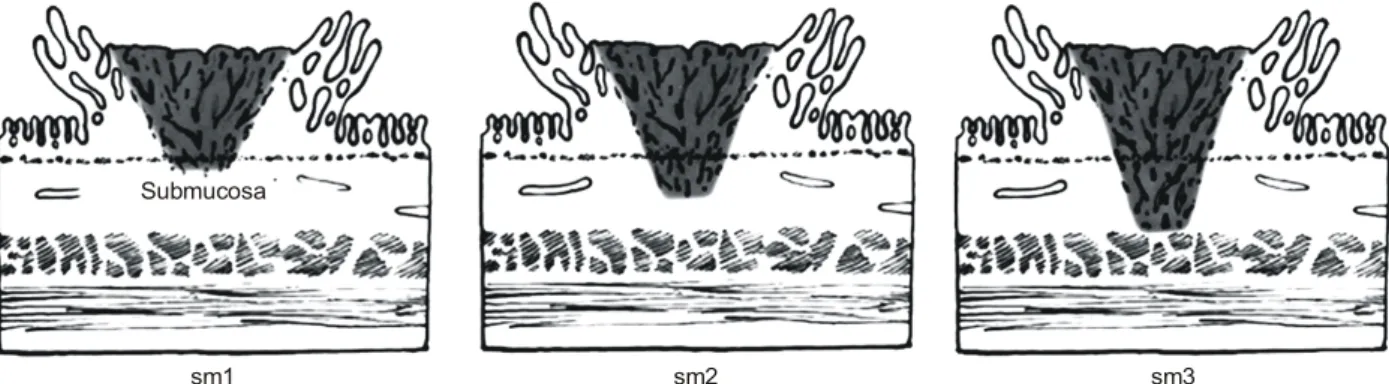 Fig.  2.  Photomicrography  of  tumor  cell  dissociation  (TCD). 