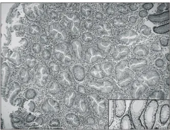 Fig.  2.  Scanning  and  image  of  expression  profiles  in  patients  with  serrated  polyps