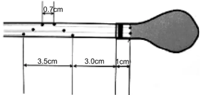 Fig.  2.  Schematic  representation  of  parameters  of  the  rectoanal  inhibitory  reflex  as  measured  in  the  study