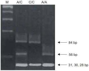 Fig.  1.  MTHFR  C677T  genotyping  RFLP  result.  The  polymor- polymor-phism  affects  HinfI  digestion  of  the  MTHFR  C677T