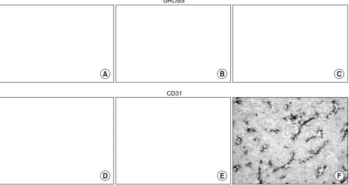 Table  1.  Tumor  sizes  and  microvessel  density  in  colon  cancer  model,  treated  with  LPS  and  LPS-thalidomide 