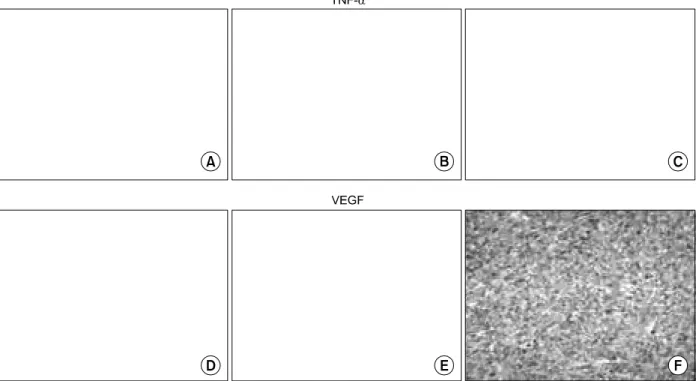 Table  2.  Semiquantitation  of  VEGF  and  TNF-α  expression  in  colon  cancer  model,  treated  with  LPS  and  LPS-thalidomide ꠚꠚꠚꠚꠚꠚꠚꠚꠚꠚꠚꠚꠚꠚꠚꠚꠚꠚꠚꠚꠚꠚꠚꠚꠚꠚꠚꠚꠚꠚꠚꠚꠚꠚꠚꠚꠚꠚꠚꠚꠚꠚꠚꠚꠚꠚꠚꠚꠚ Degree  of  expression No
