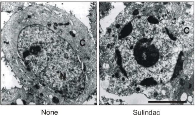 Fig.  5.  Sulindac  induces  high  molecular  weight  (HMW)  DNA  fragmentation  associated  with  apoptosis  but  no  ladder-like  DNA  fragmentation  in  HT-29  cells