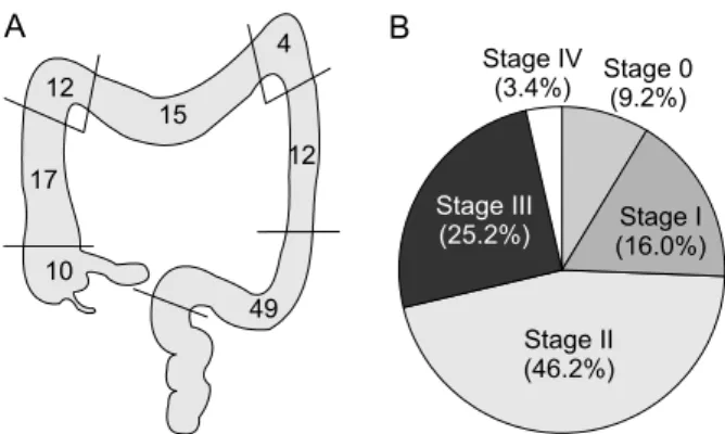 Fig.  1.  Distribution  of  tumor  locations  (A)  and  stages  (B).