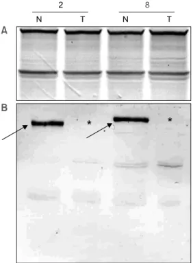 Fig.  2.  Immunoblot  evaluation  for  expression  of  DCC  antigen.  A.  1μg  samples  of  each  lane  were  subjected  to  10% 
