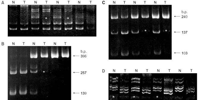 Fig.  4.  PCR-LOH  analysis  for  DCC  gene  in  colorectal  carcinomas.  A.  PCR-SSCP  analysis  using  D18S69  locus