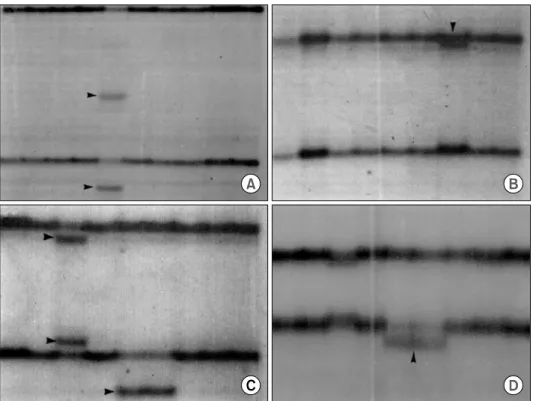Fig.  3.  Sequence  for  hMSH2  exon  13  showing  a  point  mutation  (C  for  T)  in  the  intronic  splice  acceptor  site  6  bases  upstream  of  position  2006