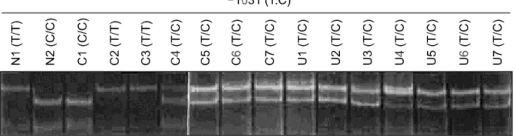 Fig.  3.  PCR-SSCP  analysis  for  the  -1031  (T：C)  sequence  polymorphisms  in  the  TNF-α  promotor