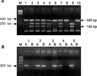 Fig.  1.  Picture  shows  a  genotyping  of  the  CYP1A1  gene  polymorphism.  A.  Genotyping  of  the  CYP1A1  gene  in  Msp  I  polymorphism