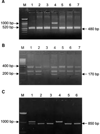 Fig.  3.  Picture  shows  a  genotyping  of  the  GSTM1  gene. 