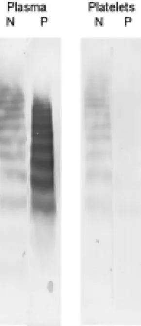 Fig.  4.  Results  of  ultrastructural  study  of  platelets  in  normal  (N,  magnification  ×17,800)  and  propositus  (P,  magnification  ×13,200  and  ×42,000)