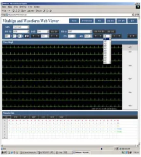 Fig.  6  Wave  graph(ECG1)  interface  display  of  vital  sign  information  web  viewer  system 