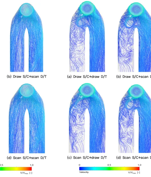 Fig. 16. Streamline distributions in D/T according to the  shapes of S/C and D/T at low flow rate