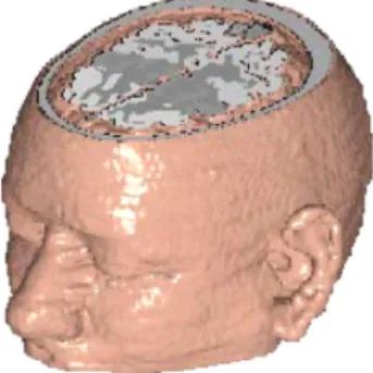 Fig.  1.  Microwave  imaging  reconstruction  result  based  on  computer  simulation  from  Semenov  and  Corfield.