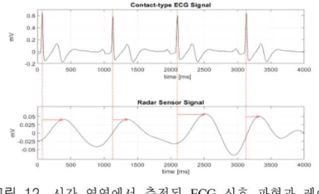 그림  12.  시간 영역에서 측정된 ECG  신호 파형과 레이 다 신호 파형