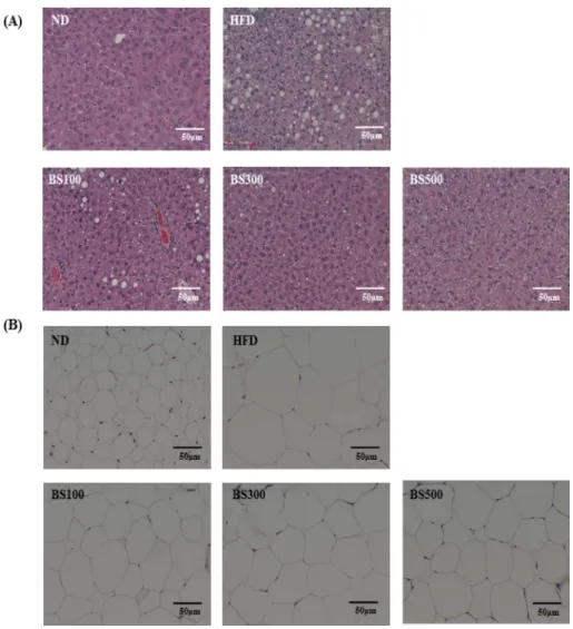 Fig. 7. Effects of BS on hepatic fat accumulation (A) and size of adipocyte (B) in mice fed a high-fat-diet (200X)